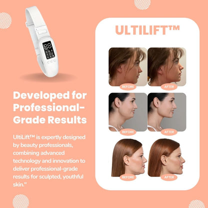 UltiLift™ Chin & Neck Massager